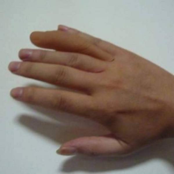 Sixth Finger (normal)